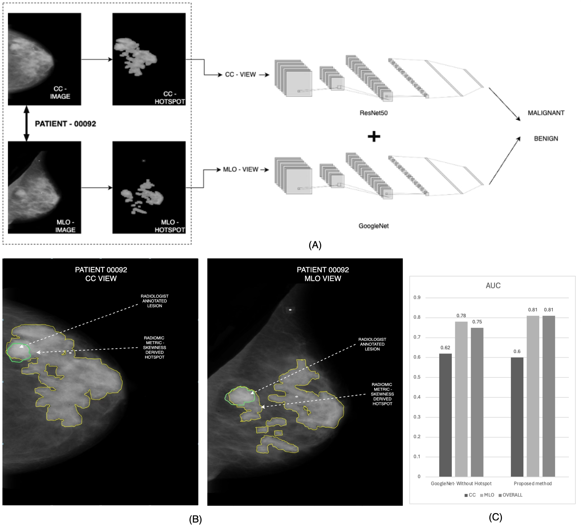 Radiomics-based Automated Hotspot Segmentation