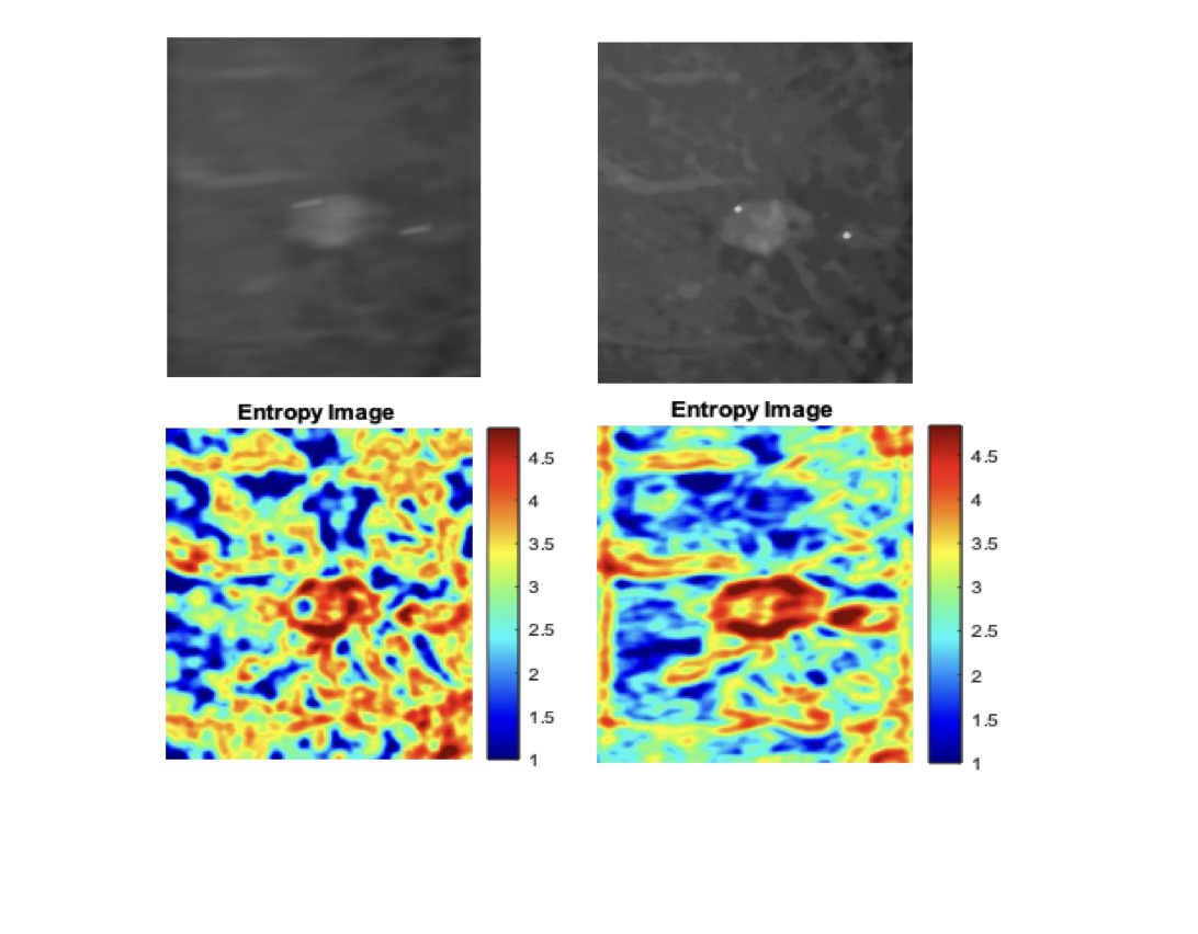 CEUS Motion Compensation